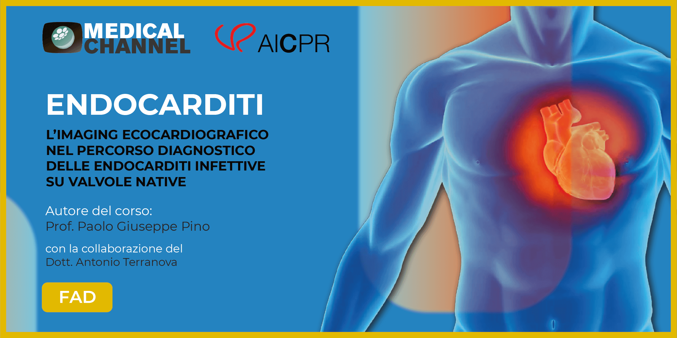 Endocarditi. L'imaging cardiografico nel percorso diagnostico delle endocarditi delle valvole native - FAD